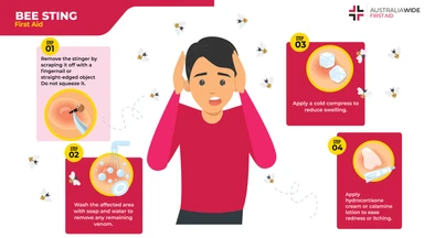 first-aid-for-bee-stings
